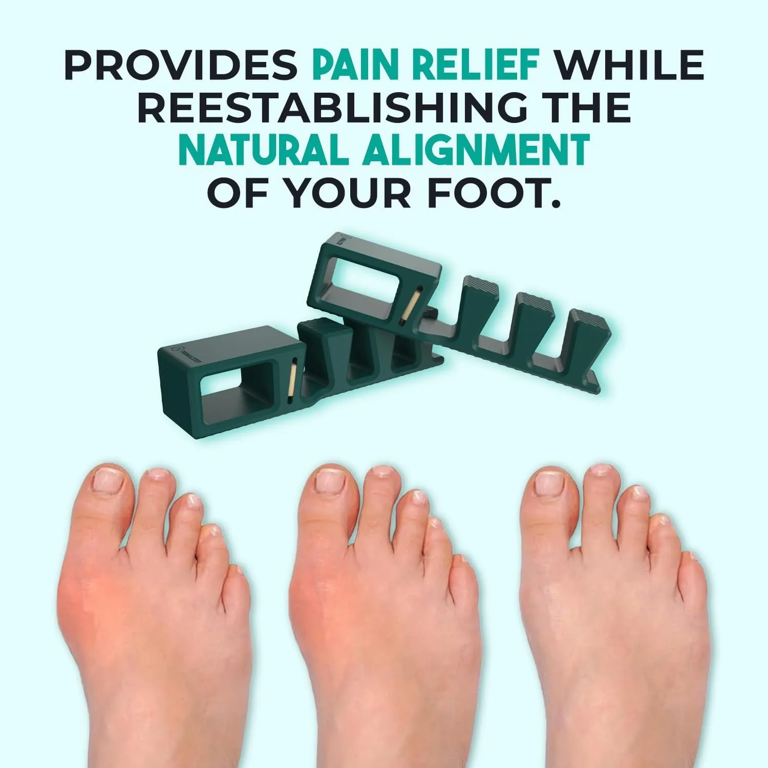 APEX Adjustable Toe Separators - over 50% Thicker & More Durable - Doctor Recommended - Stretches to Fit - 4 Pack Adjustable Bundle (1 Pair Size S/M & 1 Pair Size Large) (Green)