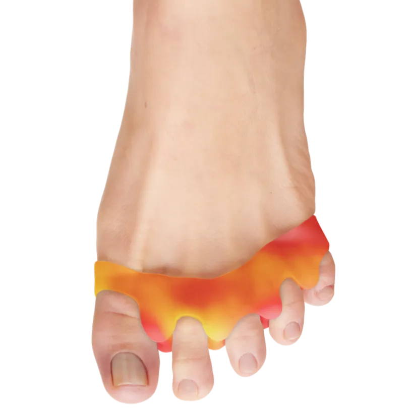 Gel Spacers for Correct Toe Alignment